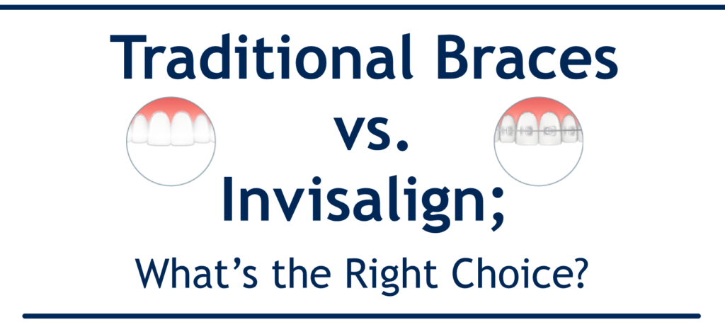 Traditional Braces vs Invisalign; What’s the Right Choice for Me - Airdrie Springs Dental Alberta