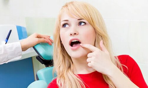 DO MY WISDOM TEETH NEED TO BE REMOVED? - Airdrie Springs Dental
