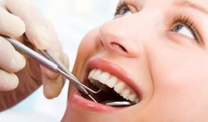dental fillings dentist Airdrie springs dental