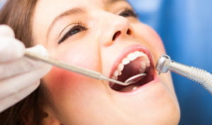 oral dentist Airdrie Springs Dental