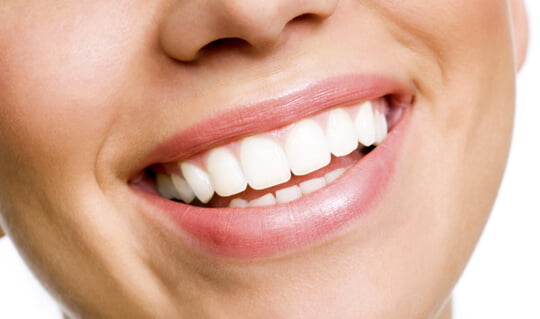 teeth whitening Airdrie springs dental