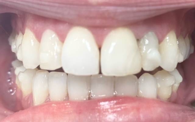 Before & After Case Study - Airdrie Springs Dental