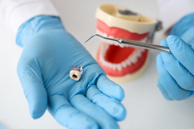 How to Prepare for Dental Procedures