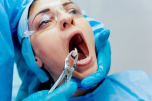 tooth extraction airdrie