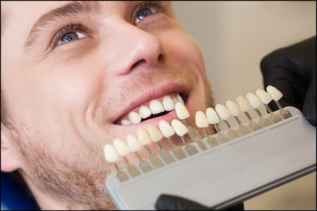 Smiles men dentist Airdrie Alberta