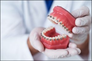 Choose Airdrie Spring Dental for Orthodontics Treatment
