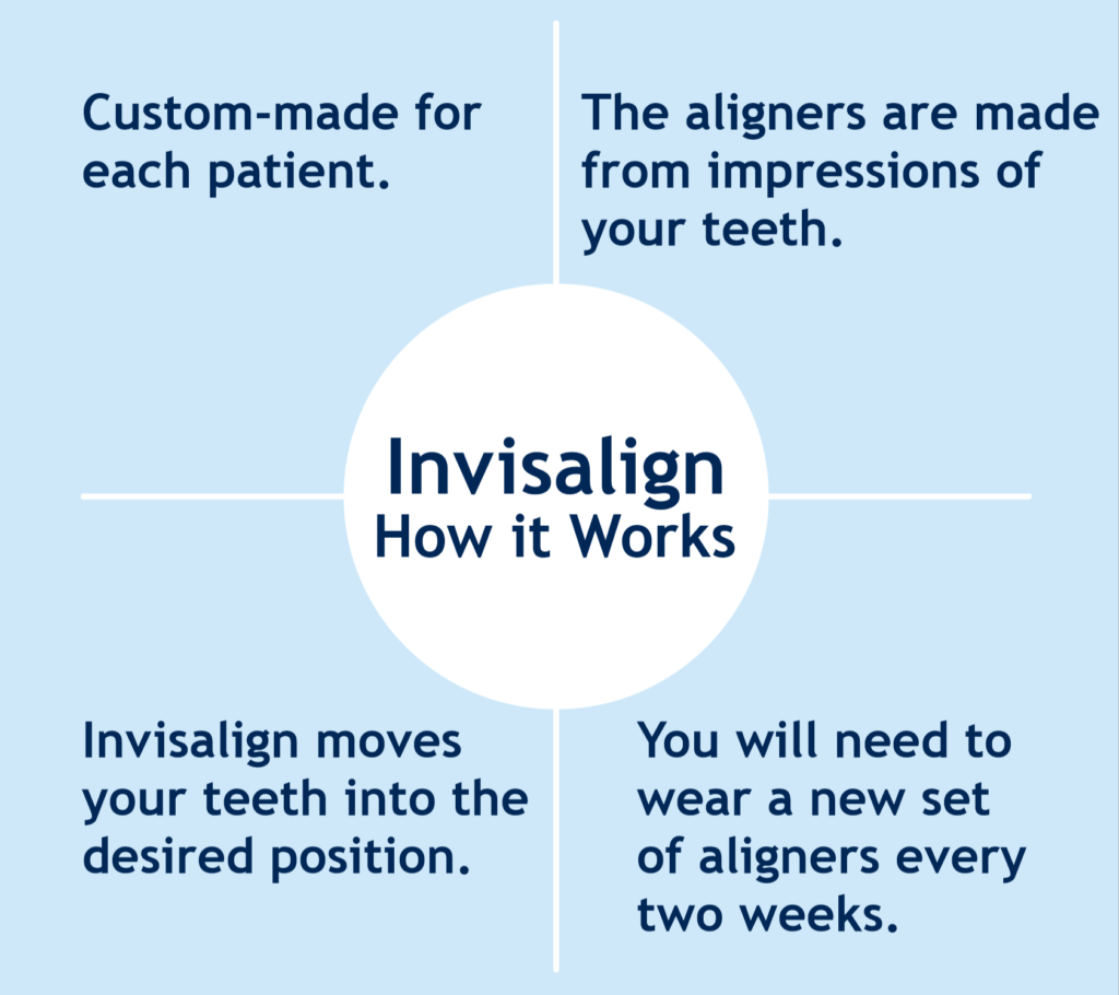Invisalign aligners Airdrie- clear teeth aligners