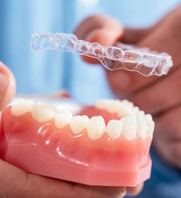 Invisalign Airdrie Braces: Teeth Straightener Clear Aligners