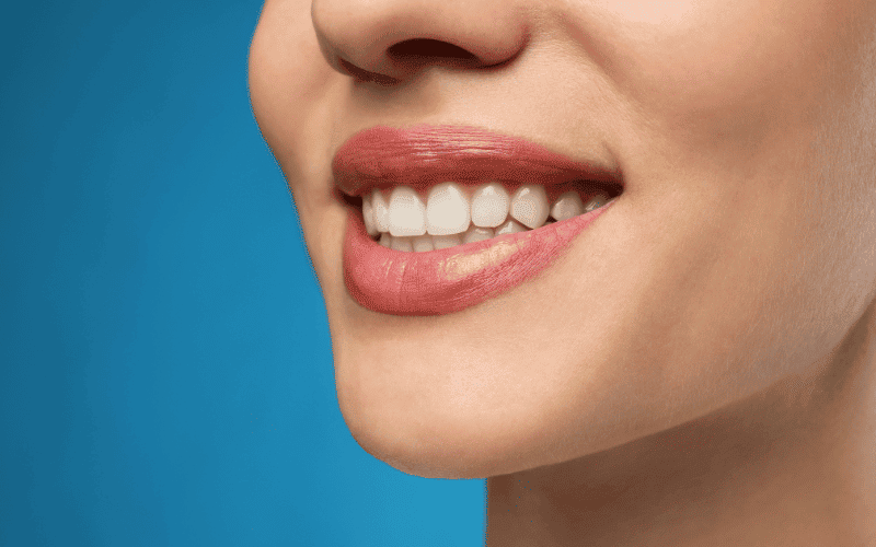 Cosmetic Dentistry