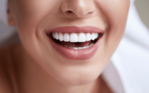 Teeth Whitening Myths