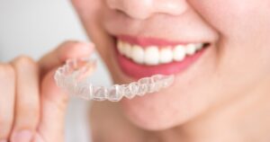 how Invisalign fixes teeth permanently